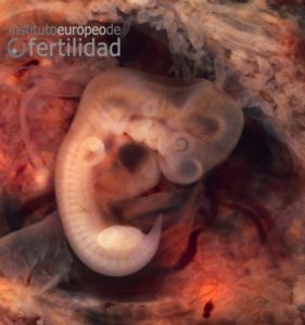 embrion-humano-instituto-europeo-de-fertilidad.jpg